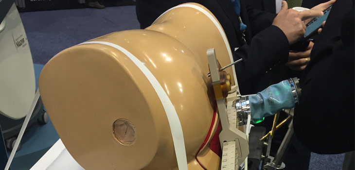 Mazor Robotics Showcases PROlif