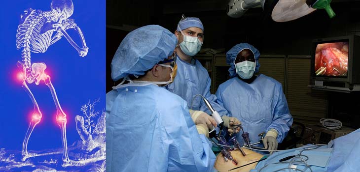 Knee, Hip Pain Reduced Via Bariatric Surgery
