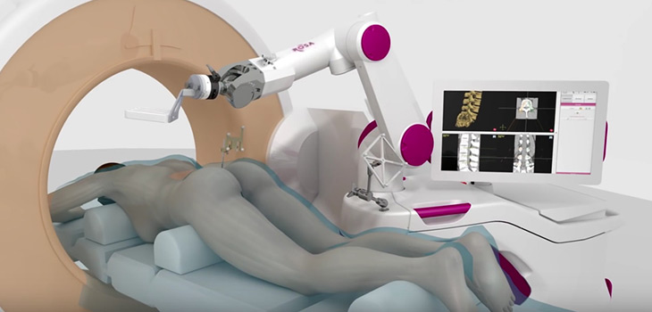 French Spine Robotic Maker Obtains $15 Million