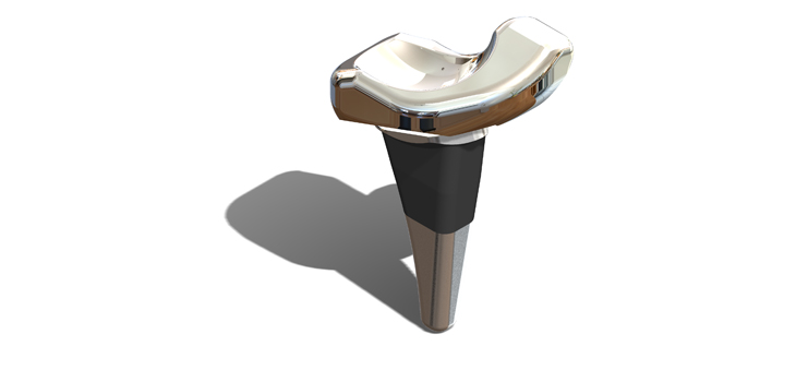 HSS, Extremity Medical, Pair Up For New Modular Partial Wrist Replacement