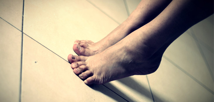 Major Pro-inflammatory Response With Intra-articular Ankle Fractures