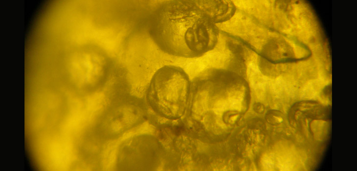 British Aim Blood Bubbles at Arthritis