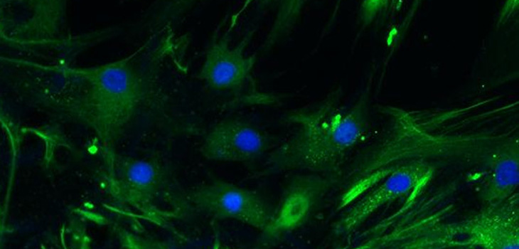 New Drug Could Heal Bones Better and Faster