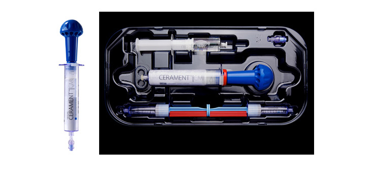Cerament Succeeds as Tumor Bone Filler