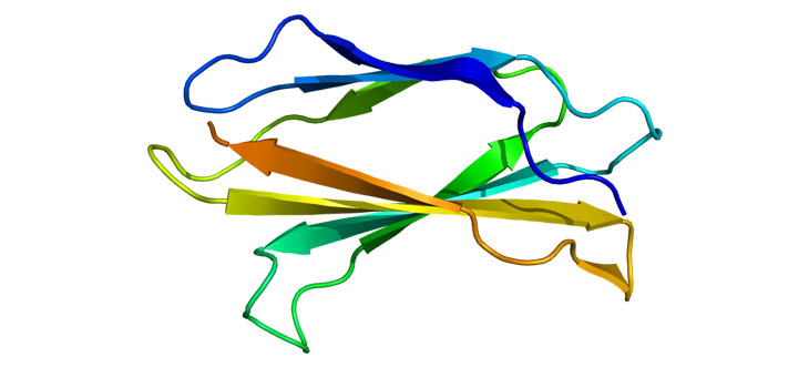 RA Marker Informs You 16 Years Before Disease Arises