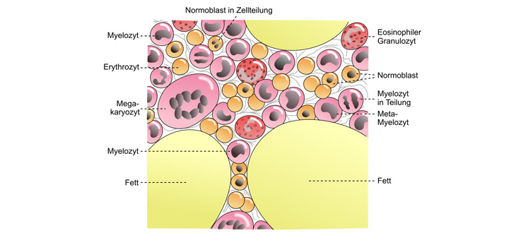 Bone Marrow-Produced Fat Cells Linked to Chronic Illness?