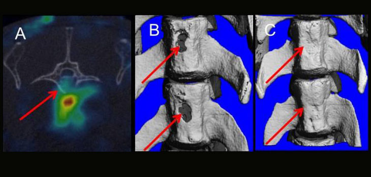 SC and PTH Increase Bone Formation, Speed Healing