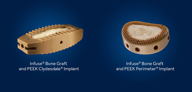 FDA Approves New Uses for Infuse