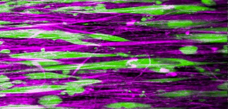 $1.125 Million to Columbia for Rotator Cuff Repair