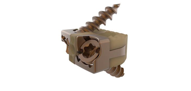 ChoiceSpine’s Cervical System Cleared for Patients
