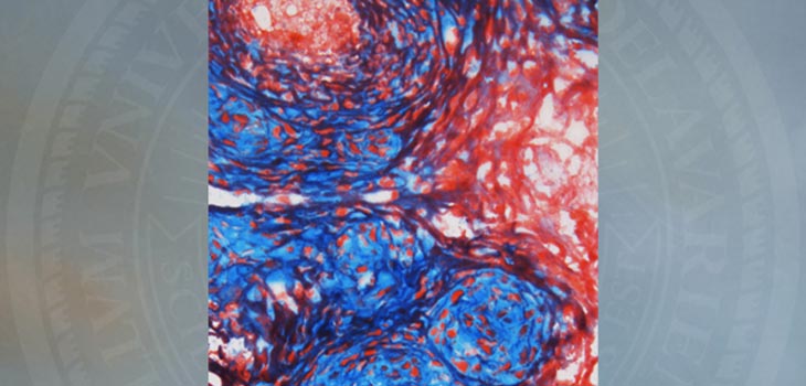 Teasing Out “Microdomains” in Tissues Could Help Meniscus Repair