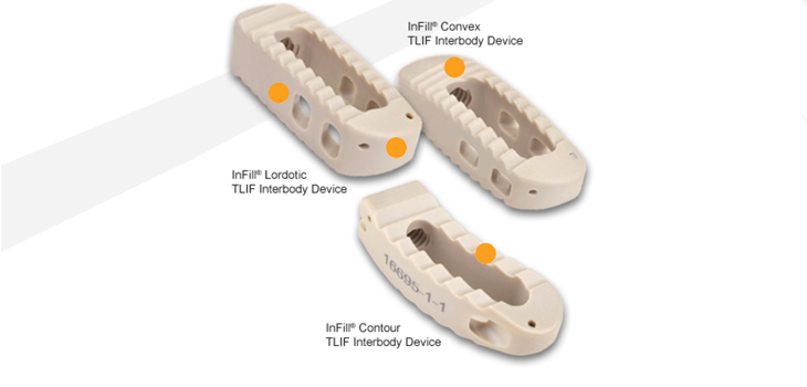Pinnacle Spine: New Patent for InFill