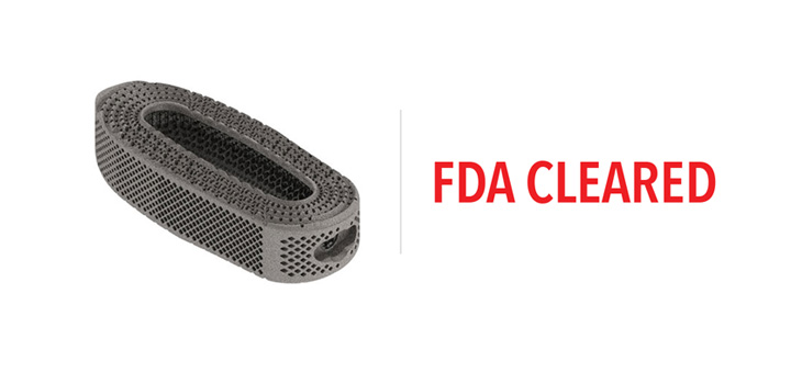 K2M’s Third Titanium Lateral Interbody System Cleared by FDA
