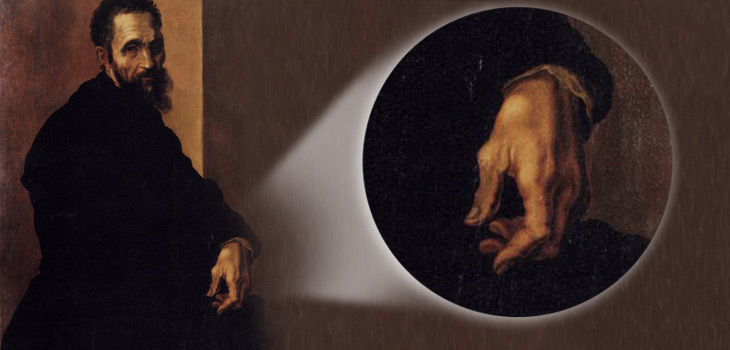 Michelangelo’s Painful Osteoarthritis