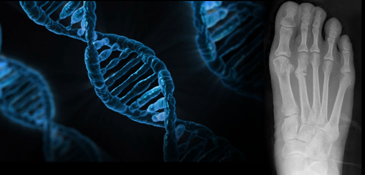 Genes Increase Stress Fracture Susceptibility // Partial Meniscectomy Not So Great After All // and More!