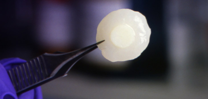 3D Printed Organs a Growing Possibility