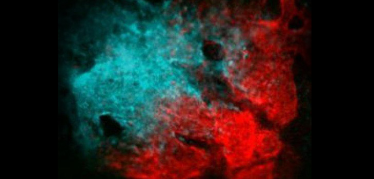 Eureka! Stem Cells Capable of Skull Formation and Bone Repair