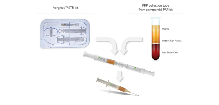 Novel Collagen Scores Well in Tendinopathy Test