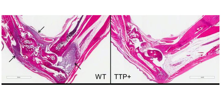 Protein Found to Protect From Inflammation