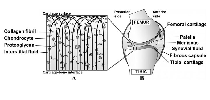 Predict Onset of OA With Fluid Flow