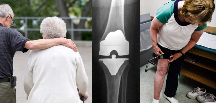 Older, Younger TKR Patients: More Pain, Less Activity