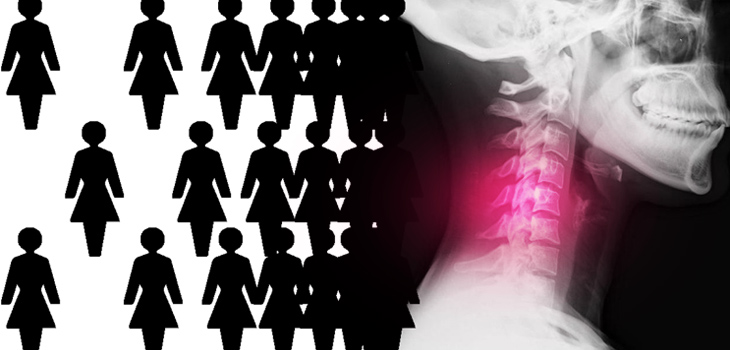 Women: 1.38X More Likely to Report Neck Pain Due to DDD
