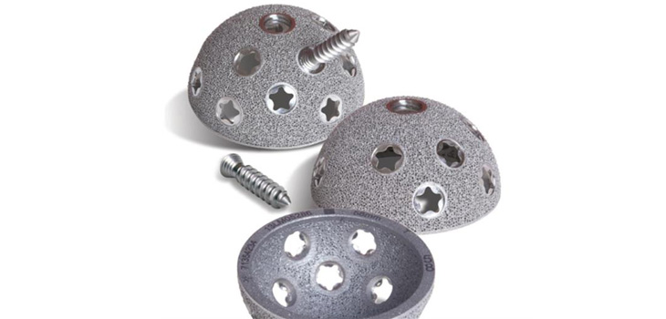 Smith & Nephew Launches New Acetabular Cup