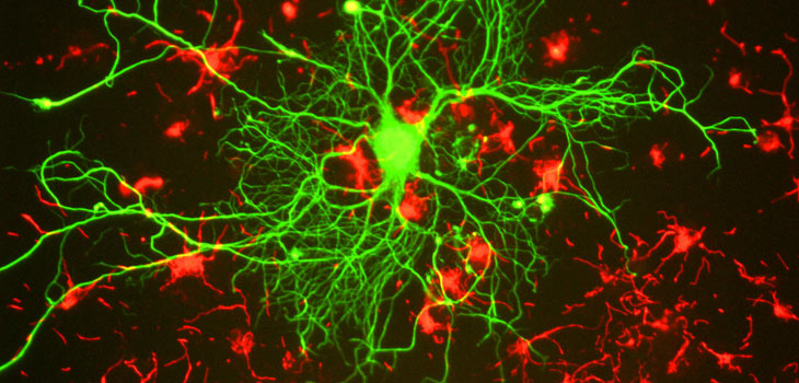 Stem Cell-Derived Neurons Regenerate Tissue in Spinal Cord