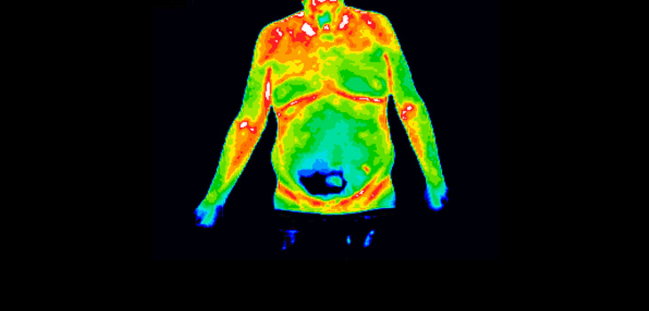 Hypothermia a Threat to Hip Surgery