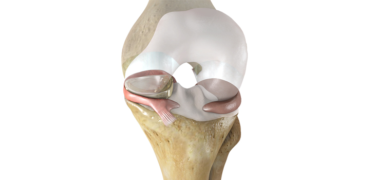 Meniscus Study Has Virginia Participant