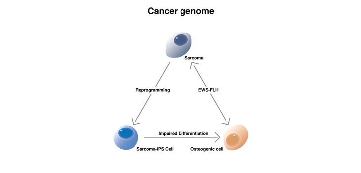 New Model for Osteosarcoma