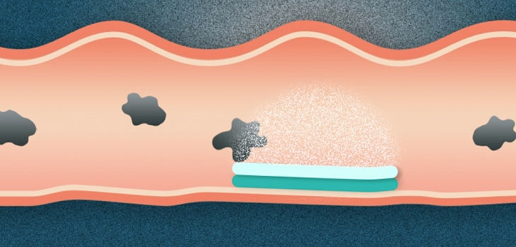 Dual-Sided Pill From MIT