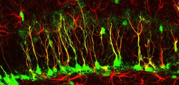 Reprogrammed Stem Cells Treat Spinal Injuries