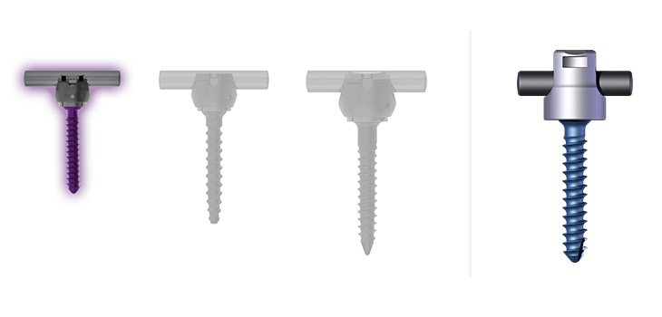 FDA Expands Indications for K2M’s Mesa and Denali Systems