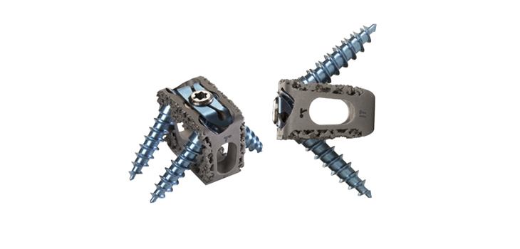 Renovis: FDA Clearance for 3D Printed Cervical Cage
