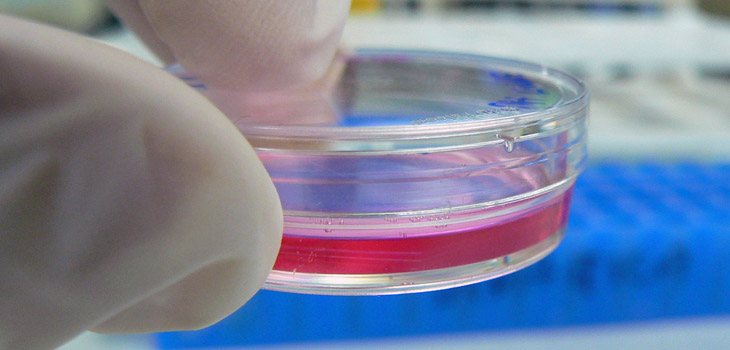 New Method With Stem Cells Aids Harvest