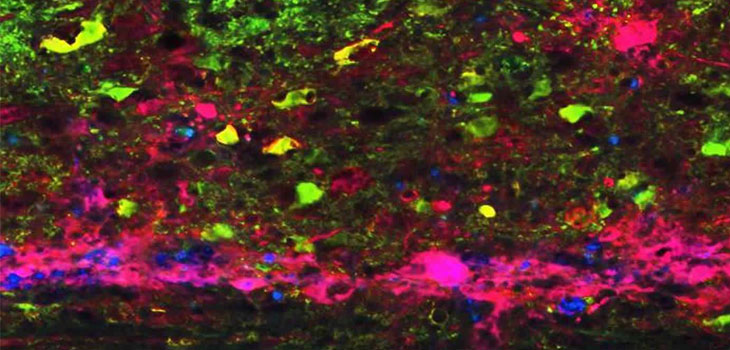 “Hyperactive” Spinal Cord Circuitry Harms Immune System // After Failed Conservative Measures, Hip Arthroscopy More Cost-Effective Than Rehabilitation // and More!