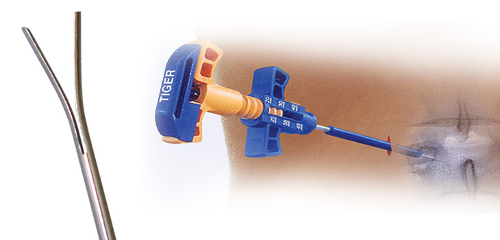 Stryker Acquires Products From SafeWire