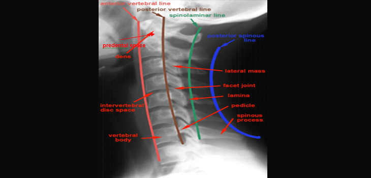 FDA Proposes to Classify Posterior Screw Systems