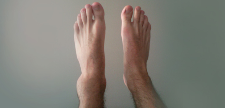 Study Supports All-Inside Arthroscopic Surgery Repairs for Unstable Ankles