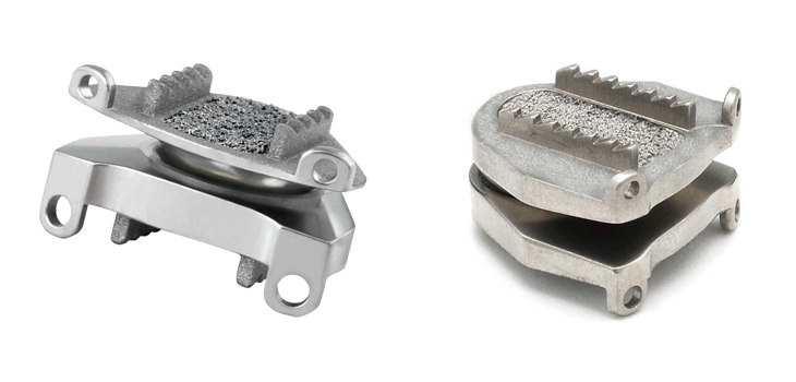 Medtronic’s Cervical Disc Beats 2-Level Fusion