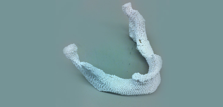 Recipe For Missing Bone: Found!