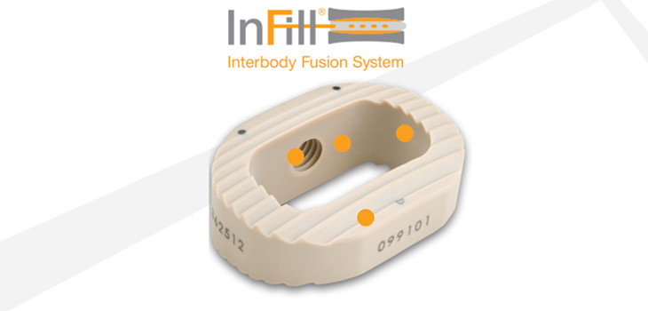 Pinnacle Spine Launches InFill ALIF