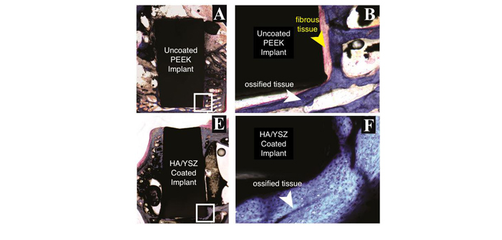 New Bioactive Film for Coating Implants