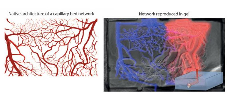 Lasers to Reduce Risk of Necrosis?