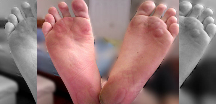 New Study: Shoes Healthier Than Barefoot Running