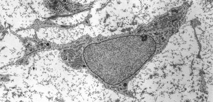Regenexx: New Stem Cell Safety Paper
