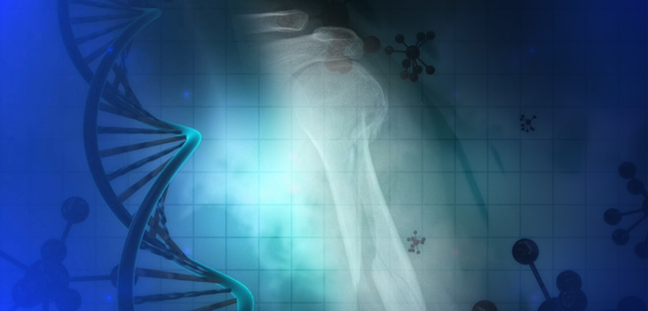 Newfound Gene May Lead to Fracture Treatment