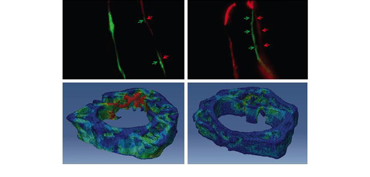 Bone Biologics Signs With UCLA for Nell-1