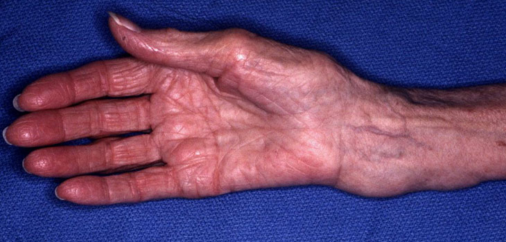 Geisinger Medical Center Recognized for Fracture Care